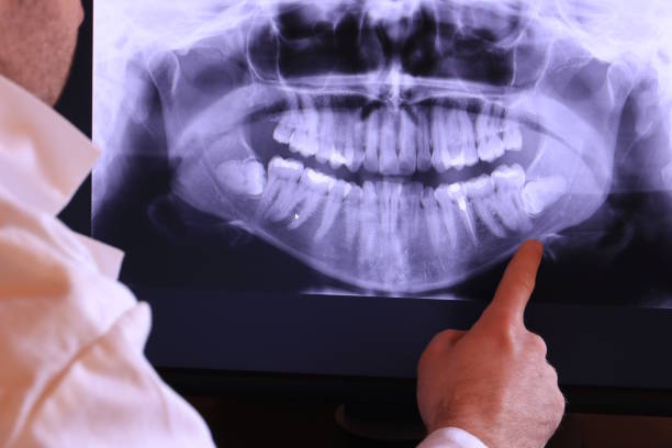 Best Emergency Root Canal Treatment in Winfield, IL