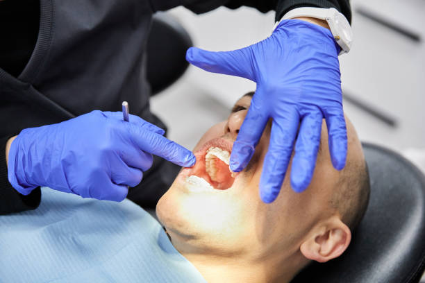 Best Emergency Tooth Extraction in Winfield, IL