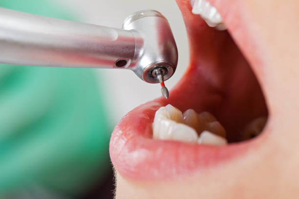 Best Emergency Dental Surgery in Winfield, IL